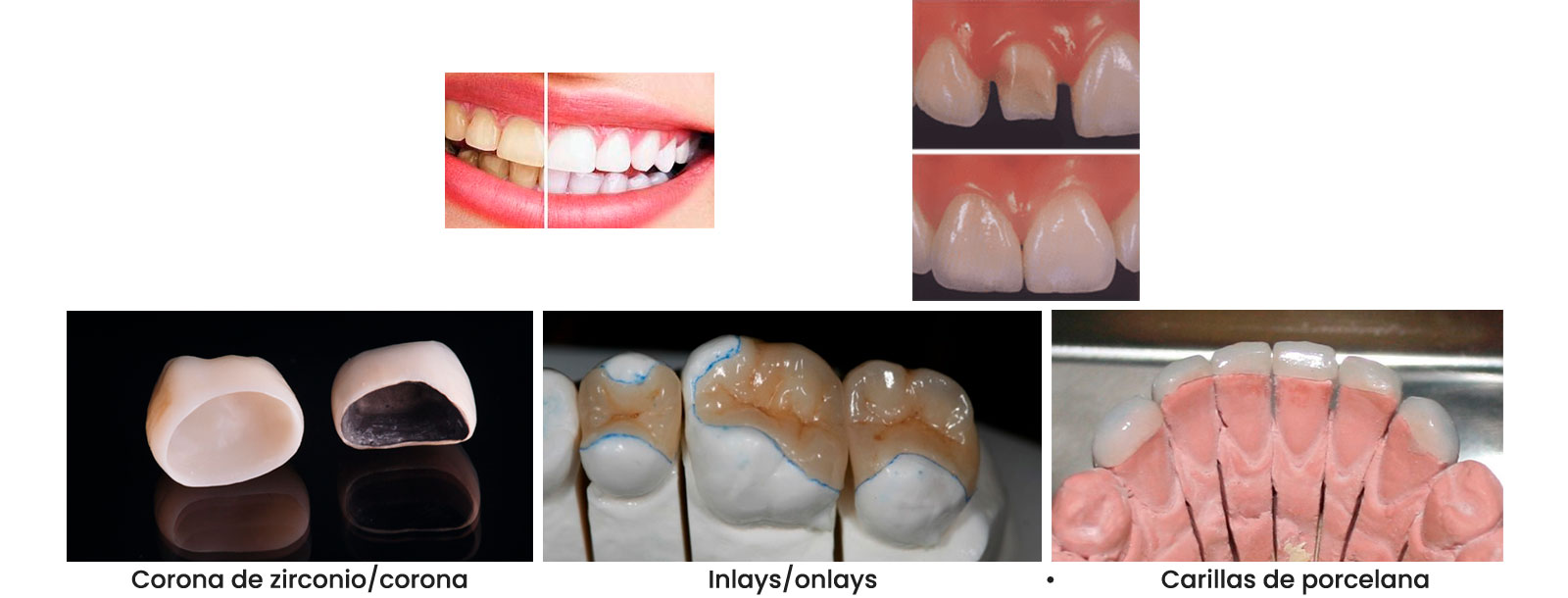Clínica Dental Noray Internacional estética dental