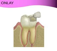 clinica-dental-noray-internacional-olay