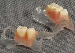 clinica-dental-noray-internacional-protesis5-0