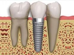 clinica-dental-noray-internacional-satellite