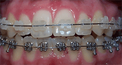 clinica-dental-noray-internacional-ortodoncia