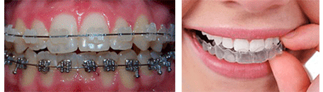 Clínica Dental Noray Internacional ortodoncia