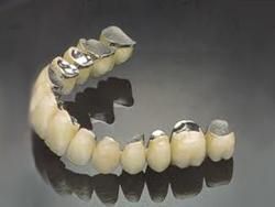 clinica-dental-noray-internacional-protesis2-0