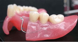 clinica-dental-noray-internacional-protesis6-0